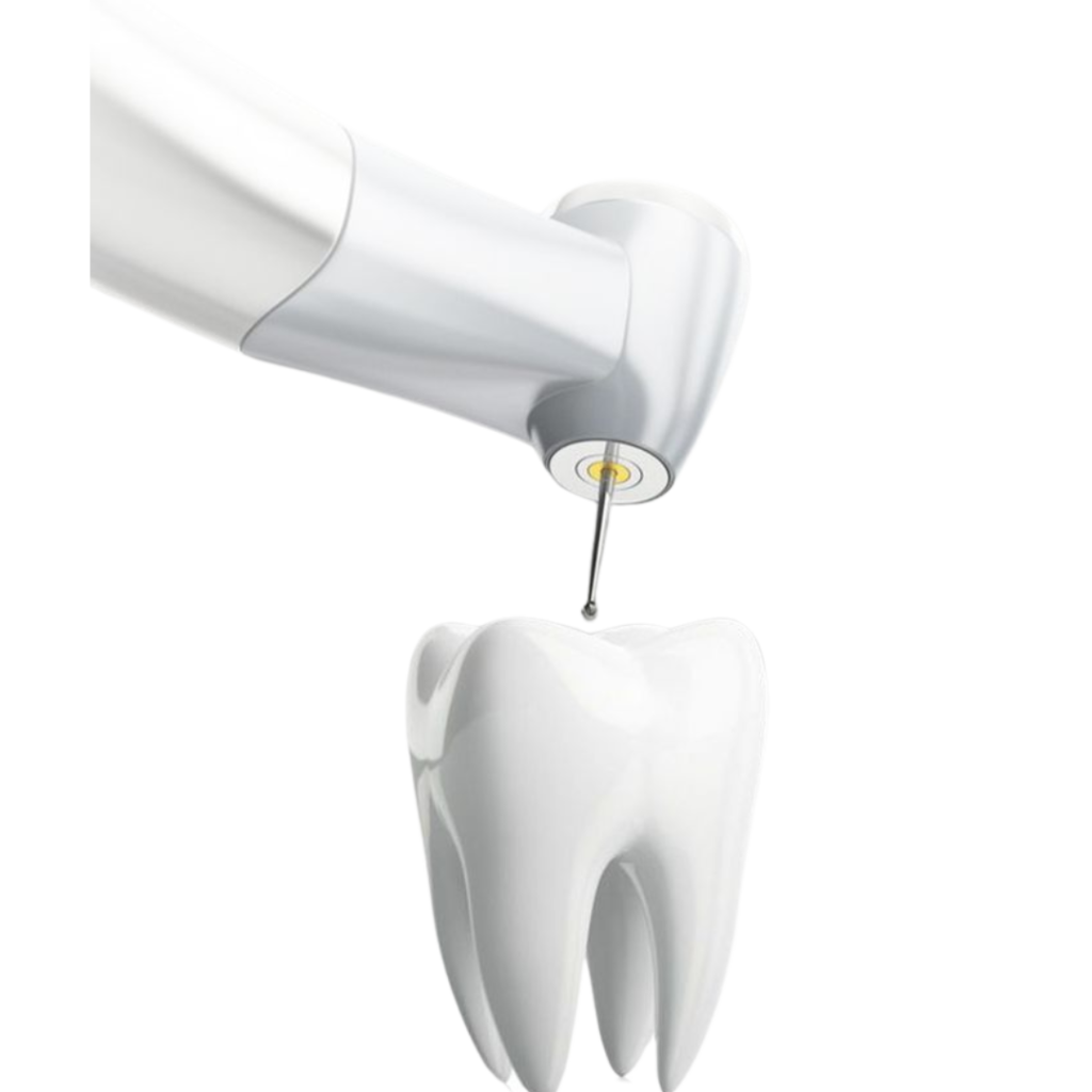 Dental tool performing treatment on a tooth.
