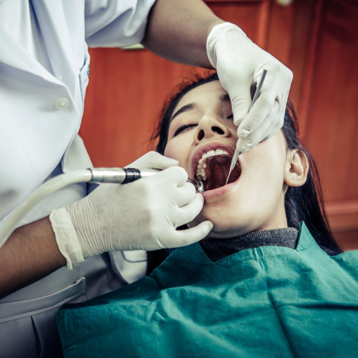 painless Root Canal Treatment (RCT)