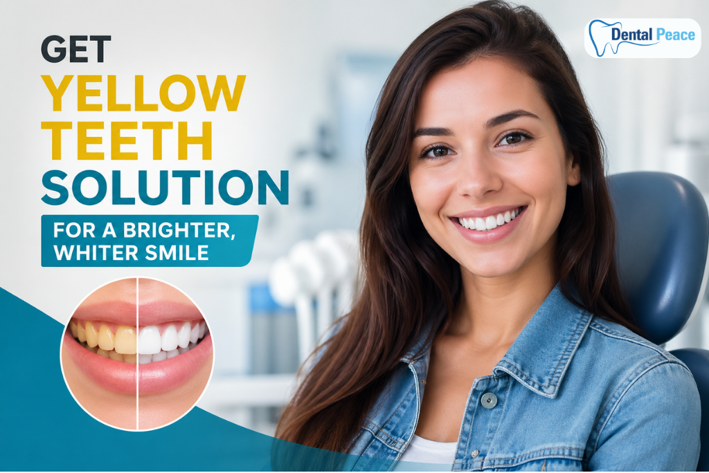 Get Yellow Teeth Solution for a Brighter, Whiter Smile - Dental Peace