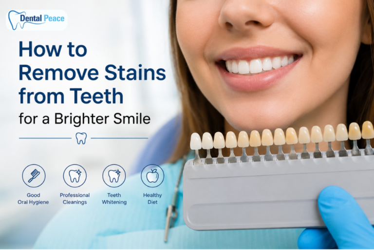 How to Remove Stains from Teeth